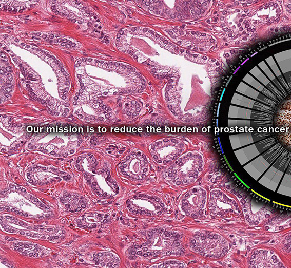 drhoseini.net/Prostate_Cancer.html دکتر سید مصطفی حسینی - سرطان پروستات-دکتر ارولوژیست تهران