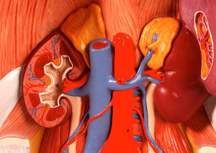 drhoseini.net/Adrenal.htmlدکتر سید مصطفی حسینی -غده آدرنال